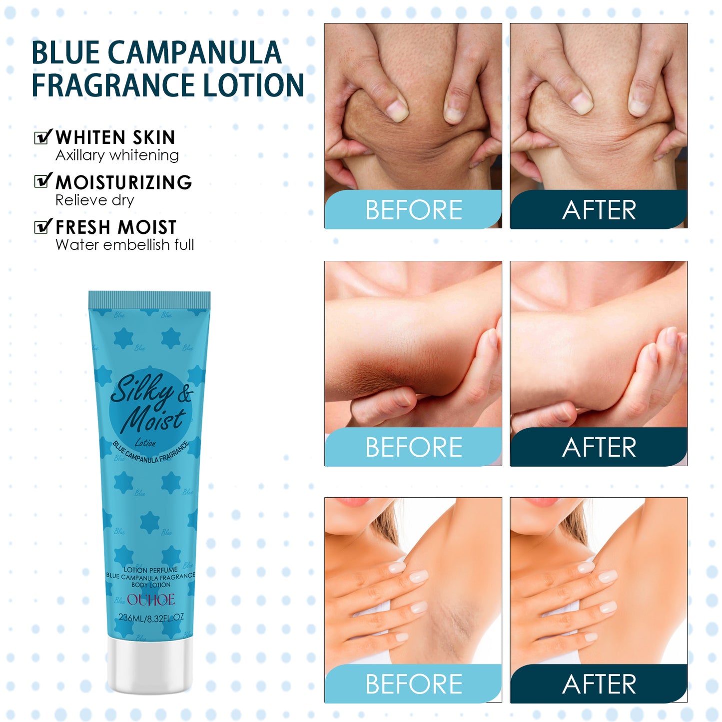 OUHOE Body Toner Lightening Armpit Knee Joint Dark Moisturizing Skin Whitening Body Beauty Care